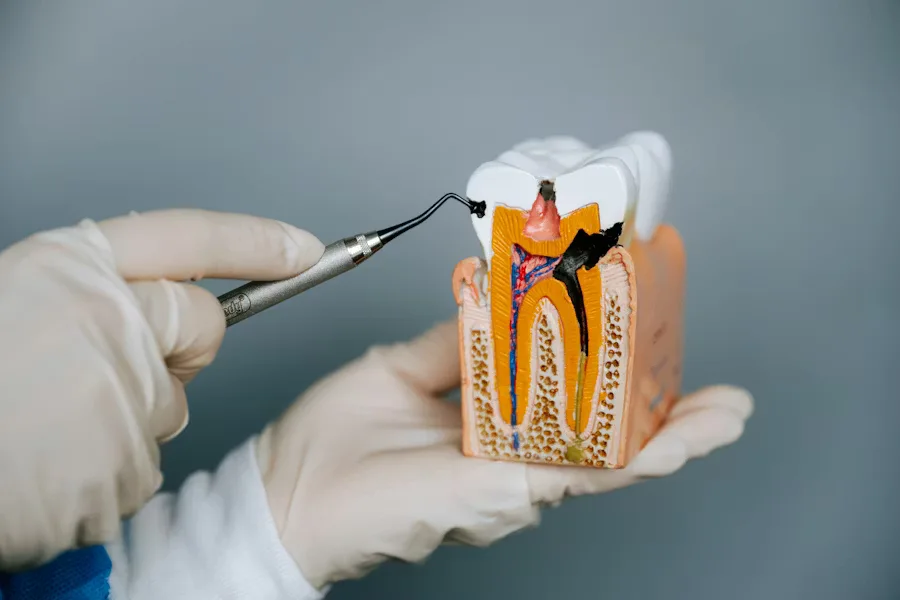 Wortelkanaalbehandeling